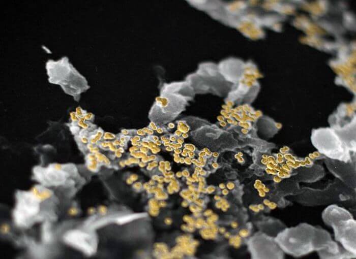 Бактерія виробляє чисте золото